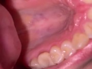 Mouth tour. Uvula and teeth  2/16