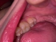 Mouth tour. Uvula and teeth  7/16