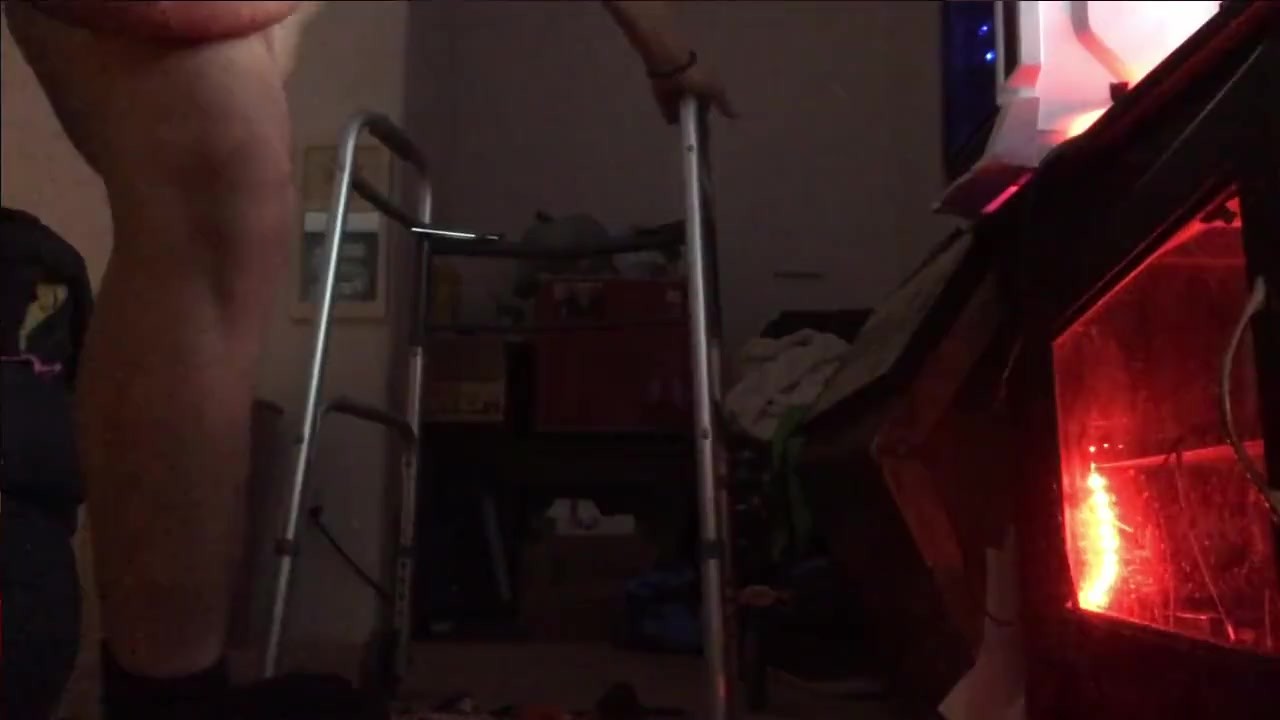 My Weird Disability 27yo amputee with lymhedema uses toys Huge load - Free Sex Video - RedTube