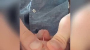 Método de André para la restauración del prepucio