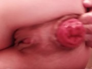 Skinny Sub pulls and plays with her prolapse 13/16