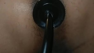 SM 肛门