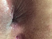 I like her Asshole Big Sexy Asshole Anal Sex Fuck 7/16