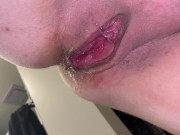 Extreme pussy stretched wide and creamy 16/16