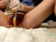 taking out the catheter and the enema with your own urine