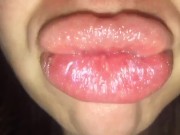 Fast Forward  - Screenshot 3 of 16 - Kiss