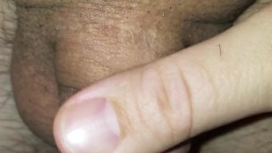 Micropenis Needing Attention