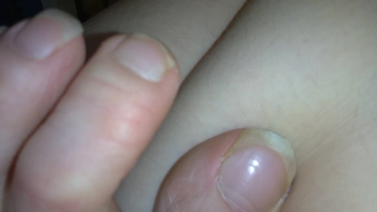 FART Fetish Slut PinkMoonLust Accidentally FARTS while making Feet Foot Play Vid Oh No She's Stinky - Free Sex Video - RedTube
