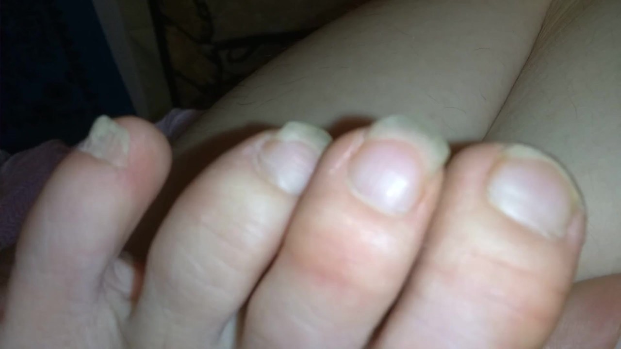 FART Fetish Slut PinkMoonLust Accidentally FARTS while making Feet Foot Play Vid Oh No She's Stinky - Free Sex Video - RedTube