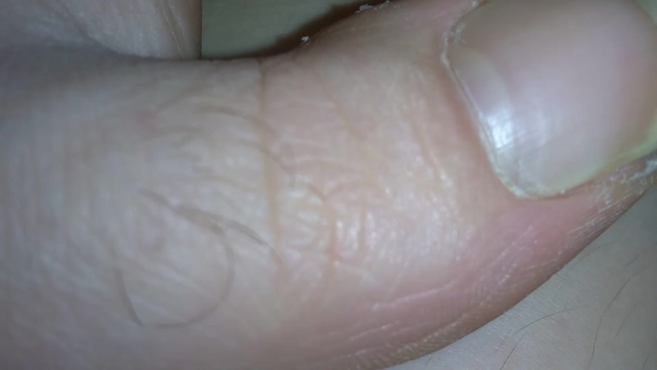 FART Fetish Slut PinkMoonLust Accidentally FARTS while making Feet Foot Play Vid Oh No She's Stinky - Free Sex Video - RedTube