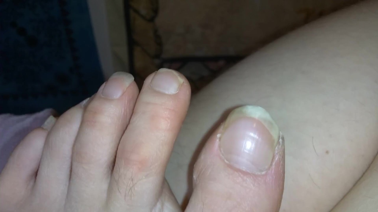 FART Fetish Slut PinkMoonLust Accidentally FARTS while making Feet Foot Play Vid Oh No She's Stinky - Free Sex Video - RedTube