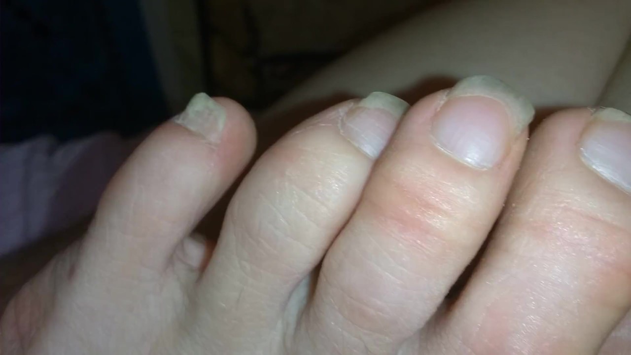FART Fetish Slut PinkMoonLust Accidentally FARTS while making Feet Foot Play Vid Oh No She's Stinky - Free Sex Video - RedTube