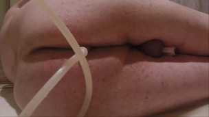 Retention Enema and Release