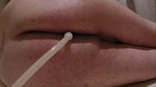 Retention Enema and Release 02