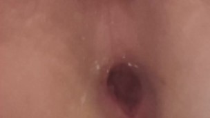 my anal is so lose and broken i cant hold anything in