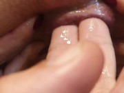 First prolapse of my ass Anal fisting that makes me squirt Anal fingering Red rose of my asshole 4/16