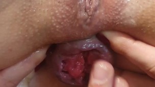 Primeiro prolapso da minha bunda Fisting anal que me faz esguichar dedilhado anal Red rosa