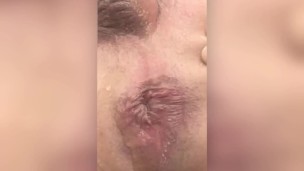 PISSING ON ASSHOLE EXTREME CLOSE UP
