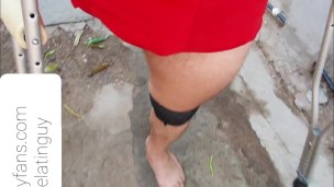 Amputee guy walking with crutches