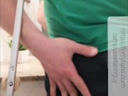 Amputee guy touching his stump