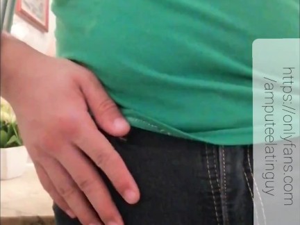 Amputee guy touching his stump