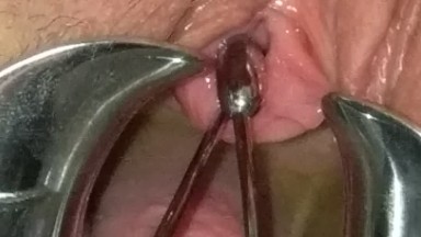 Extreme BDSM Female Urethral Stretching Medical Fetish Speculum Peehole Play