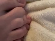 Hot webbed toes