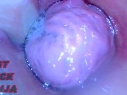 Juicy Japanese pussy endoscope view