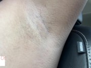 armpit hair even after laser removal glimpseofme