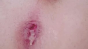 Anal Fuck, Gape, Dildo - 10