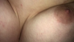 Gynecomastia