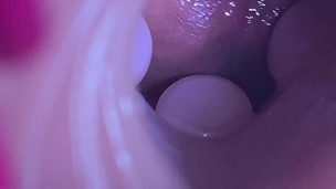 Huge Creampie In My Fleshlight