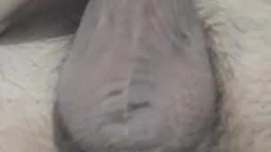 Hairy Balls