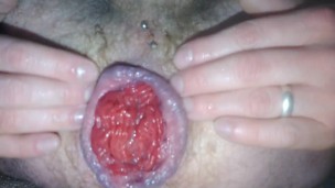 Gay guy plays with his cummy prolapse