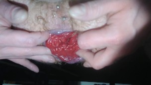 Gay guy plays with his wrecked hole