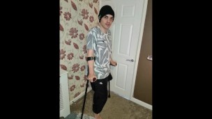 Young Welsh Amputee Twink With Crutches Compilation Wheelchair Disabled