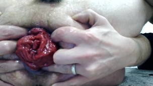 Gay prolapse training