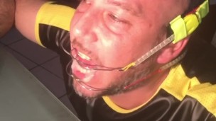 Cum on my new braces in chastity to inaugurate them