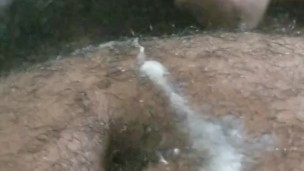 Another shot at life . 