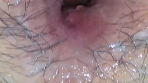 Near Gape Farts
