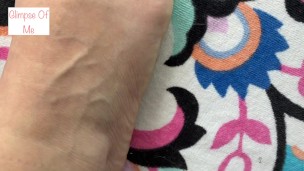 New shoes with dog print and ouch toe - GlimpseOfMe