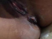 Nurse Part2 Ipakain mo tamod ko sa asawa mo. Let your husband eat my cream.... 16/16