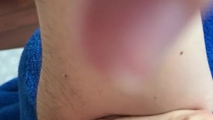 Arm pimple popping 