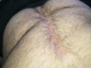 Hairy Bearded handsome amputatee 10/16