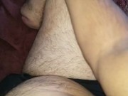 Hairy Bearded handsome amputatee 3/16