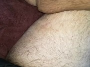 Hairy Bearded handsome amputatee 4/16