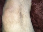 Hairy Bearded handsome amputatee 5/16