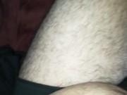 Hairy Bearded handsome amputatee 7/16