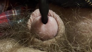 Painful sound removal ends with golden surprise
