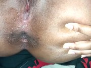 anal in missionary gaping 12/16